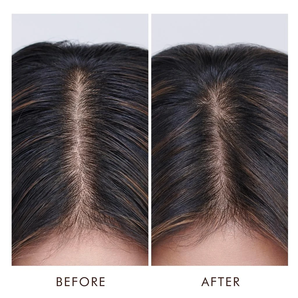 Moroccanoil Moroccanoil Oily Scalp Treatment 1.5 oz 4