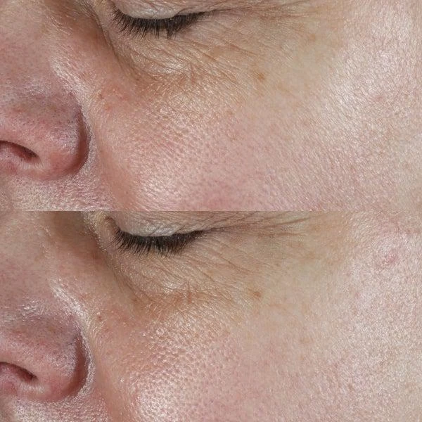 Perricone MD Perricone MD HPC Face Firming Serum 2oz FG 4