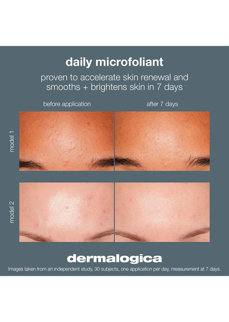 Dermalogica Travel Daily Microfoliant 13g 5