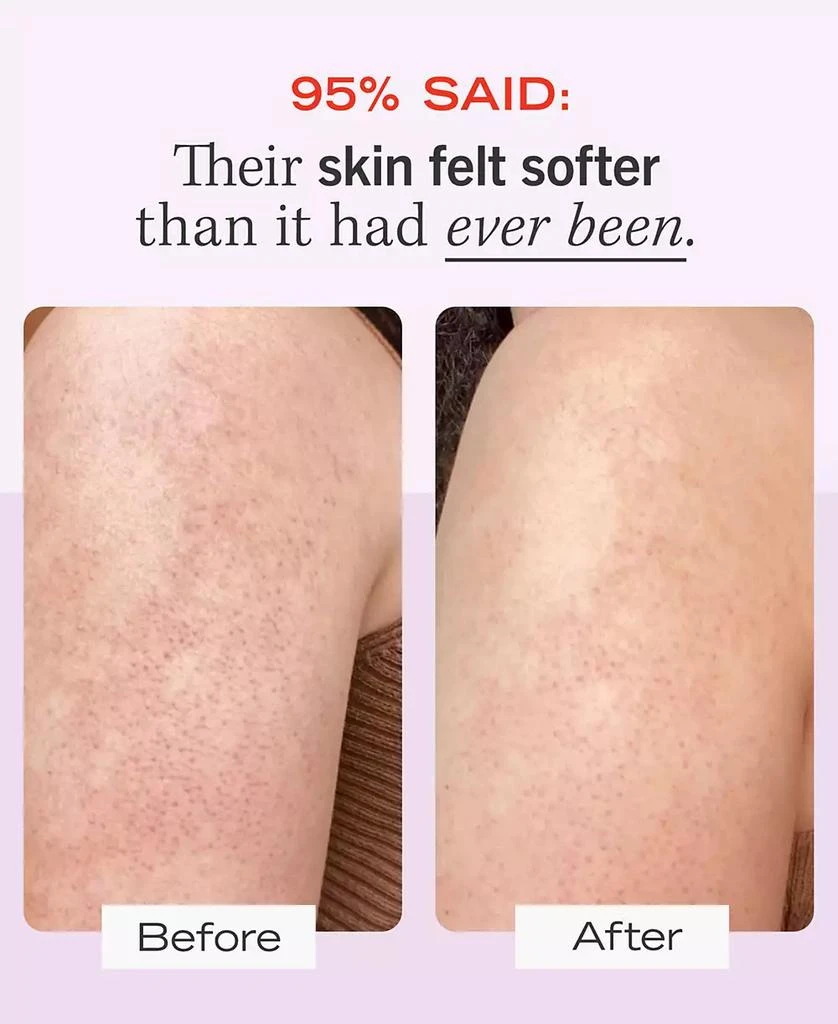 First Aid Beauty KP Bump Eraser Body Scrub with 10% AHA – Body Exfoliant for Keratosis Pilaris, 8.0 oz. 9