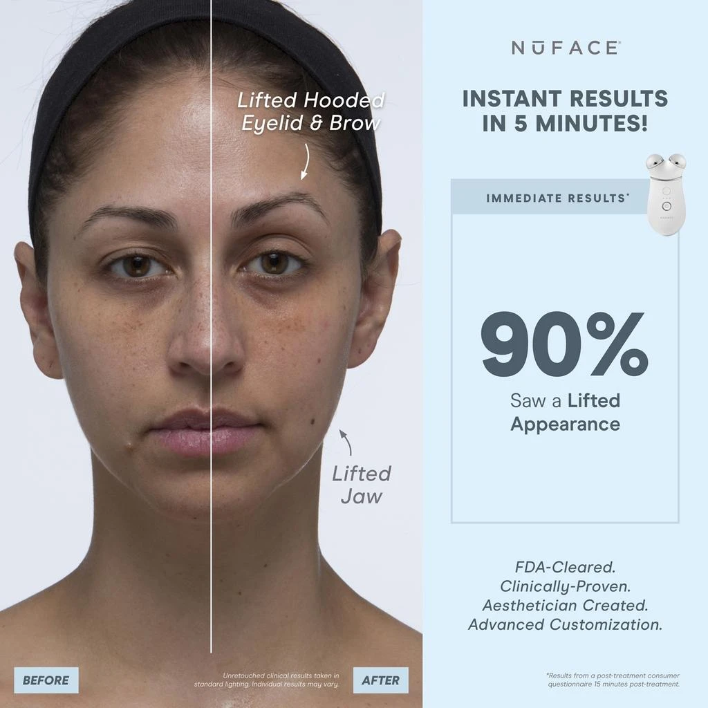 NuFace NuFACE Trinity+ Red Light and Wrinkle Reducer Attachment Set 7