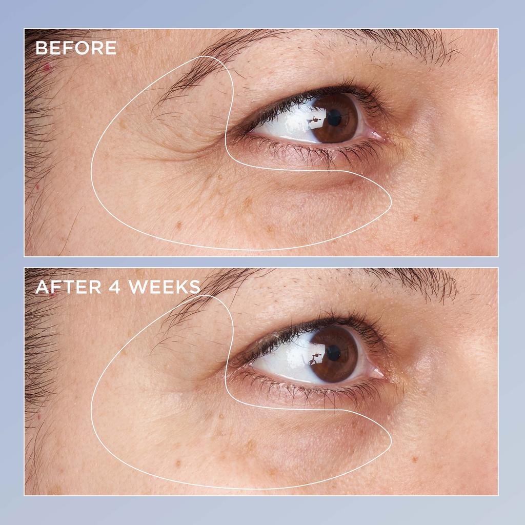Perricone MD High Potency Triple Retinol Renewal Eye Serum