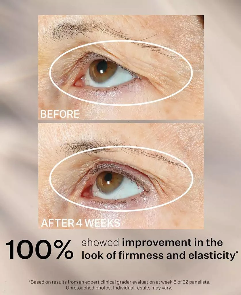 StriVectin Peptight 360 Tightening Eye Serum, 1 oz 6