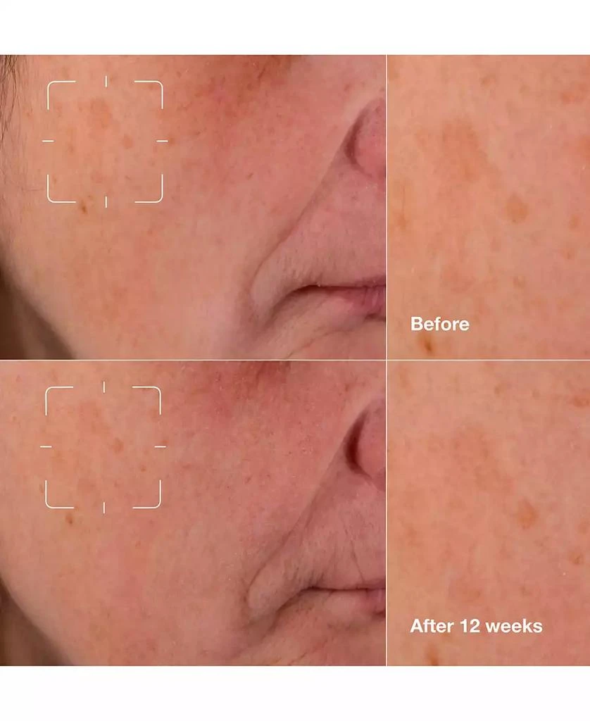 Clinique Even Better Clinical Dark Spot Clearing Serum with Vitamin C 5