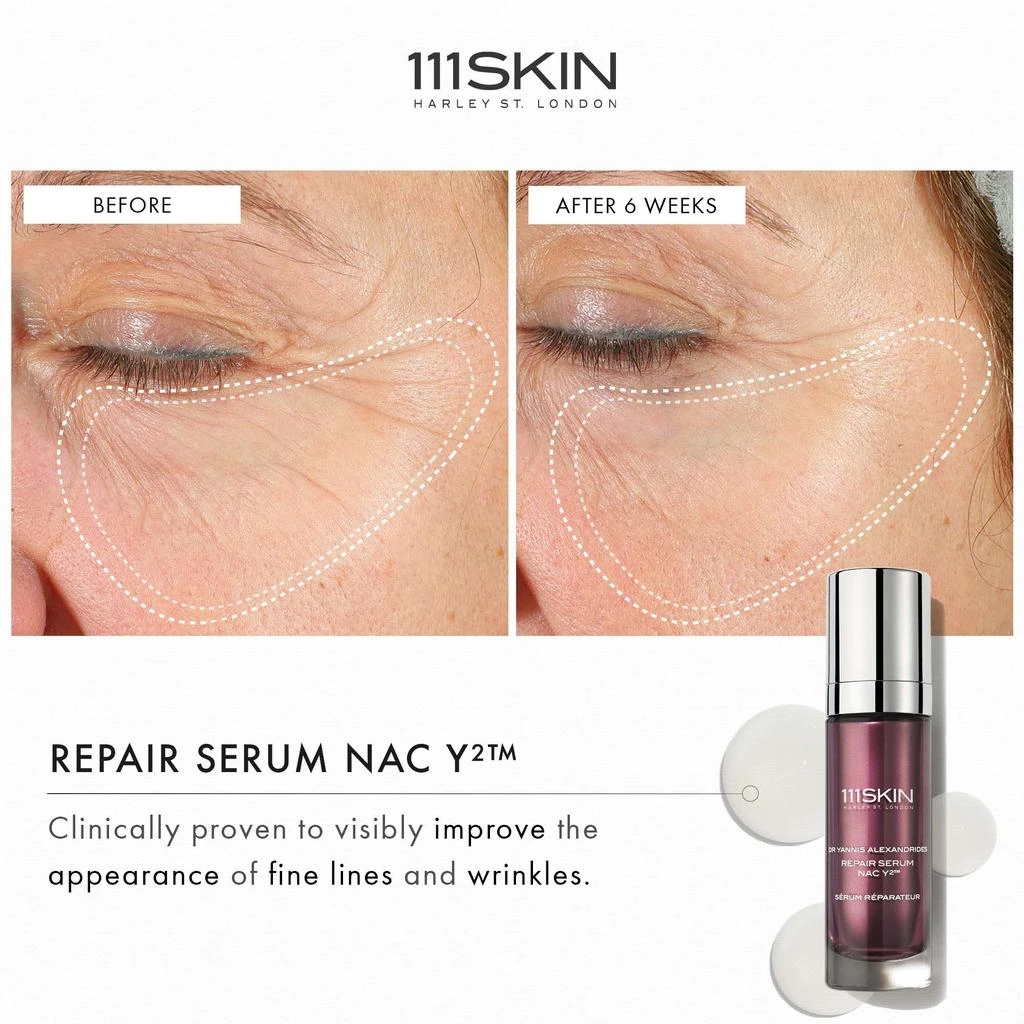 111SKIN 111SKIN Repair Serum NAC Y2 30ml 4