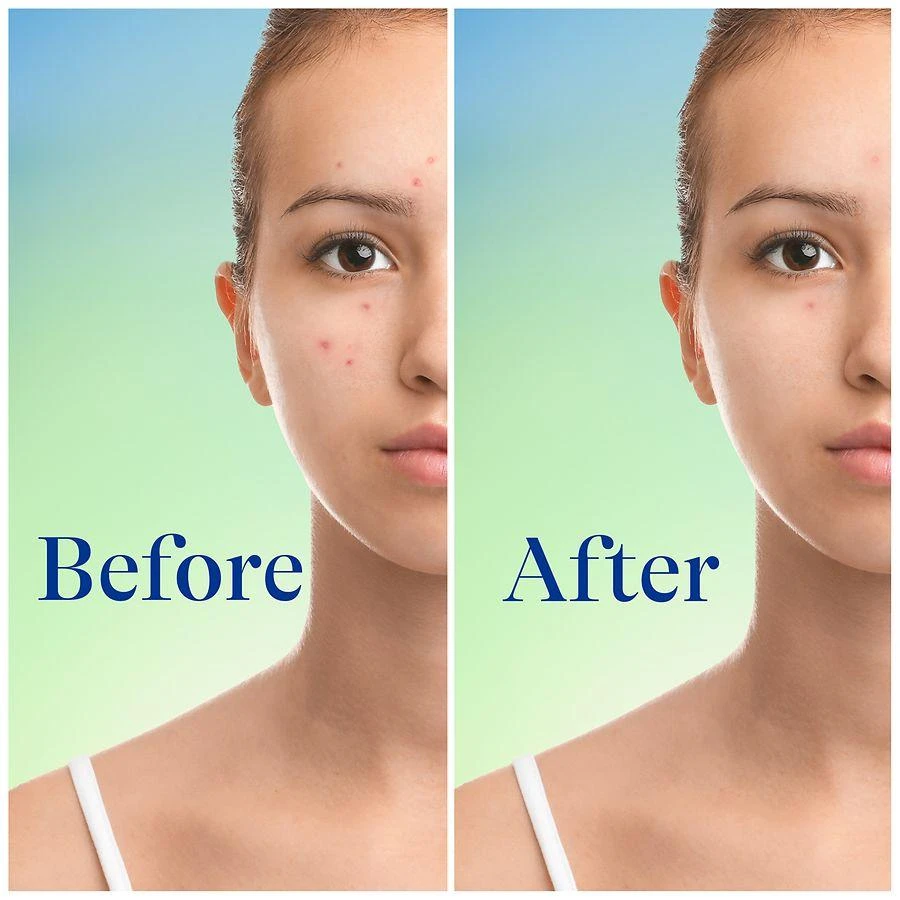 Differin Acne Foaming Cleanser 4