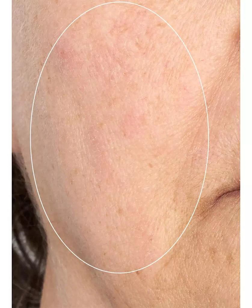 Perricone MD HP Intensive Smoothing Serum, 2.0 oz 5