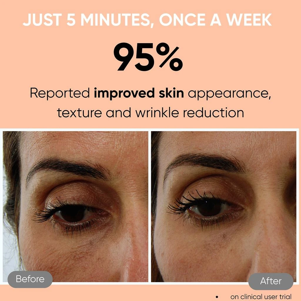 Sensica Sensica Sensilift Anti-Aging RF 7