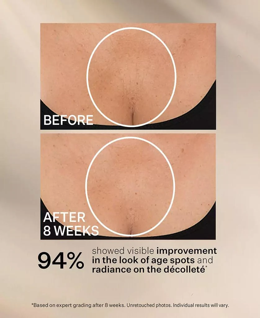 StriVectin TL Advanced Tightening Neck Cream Plus With Alpha-3 Peptide, 3.4 oz. 8