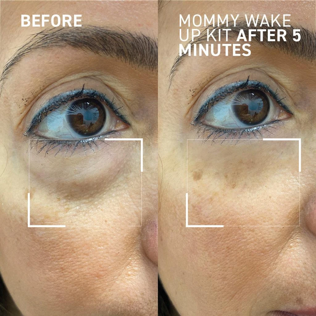 Dr. Brandt Skincare Mommy Wake Up Kit 9