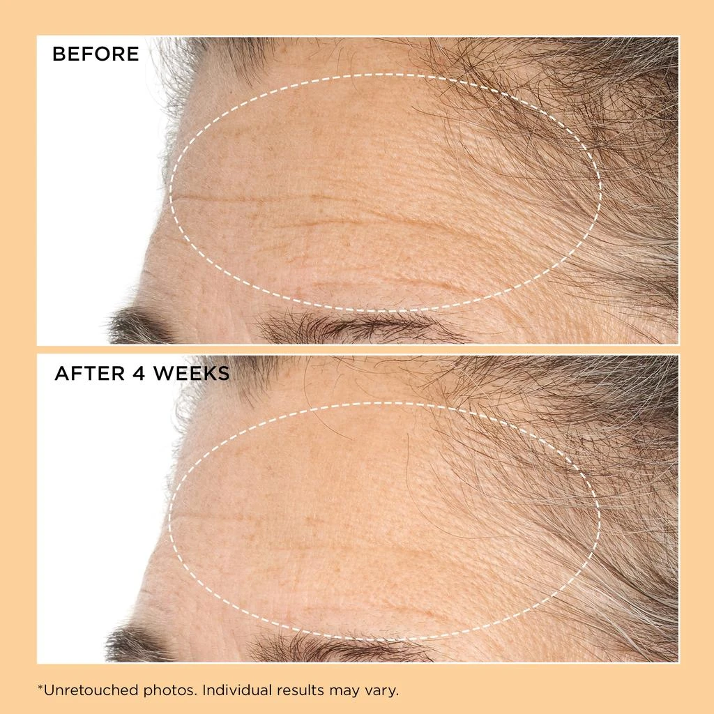 Perricone MD Neuropeptide Lift 
Correct Duo 4