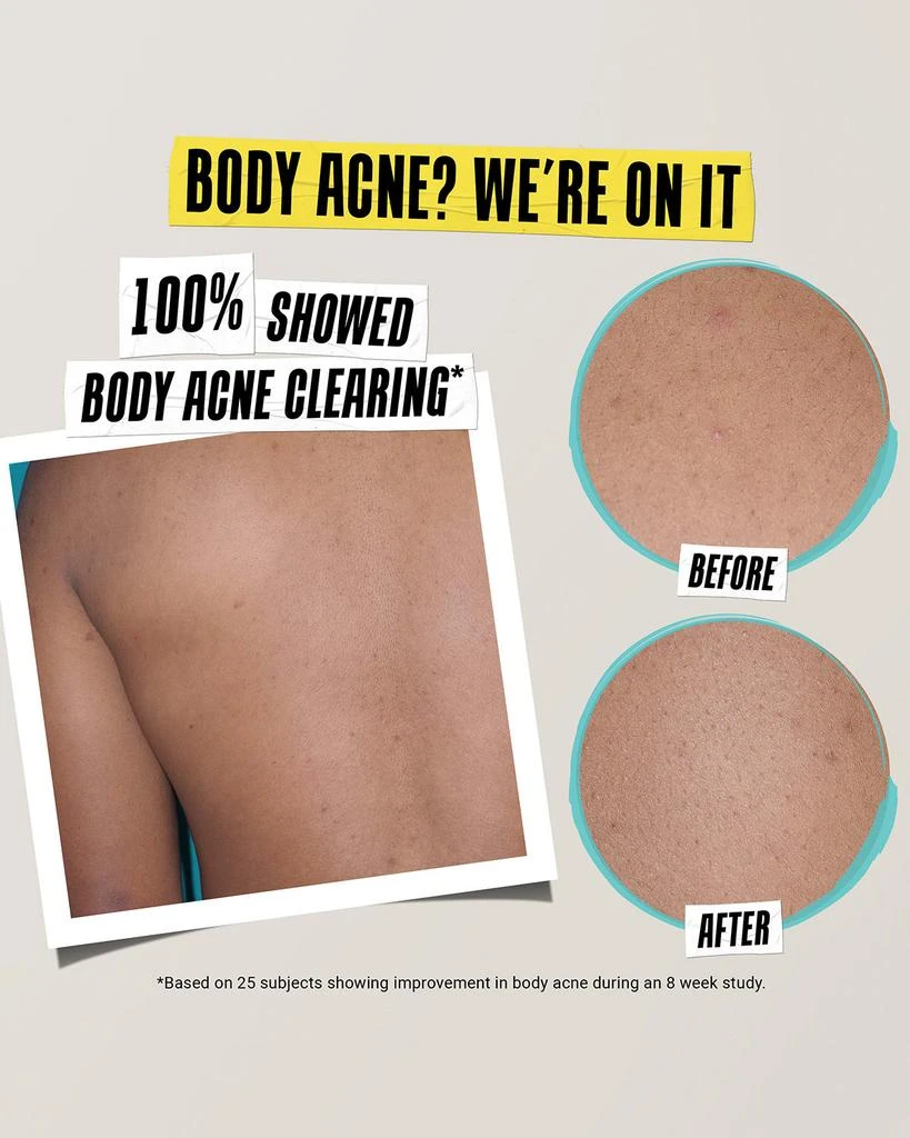 Kiehl's Expertly Clear Acne Treating & Preventing Lotion, 2 oz. 4