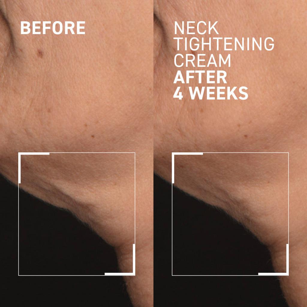 Dr. Brandt Skincare NECK TIGHTENING CREAM + GUA SHA