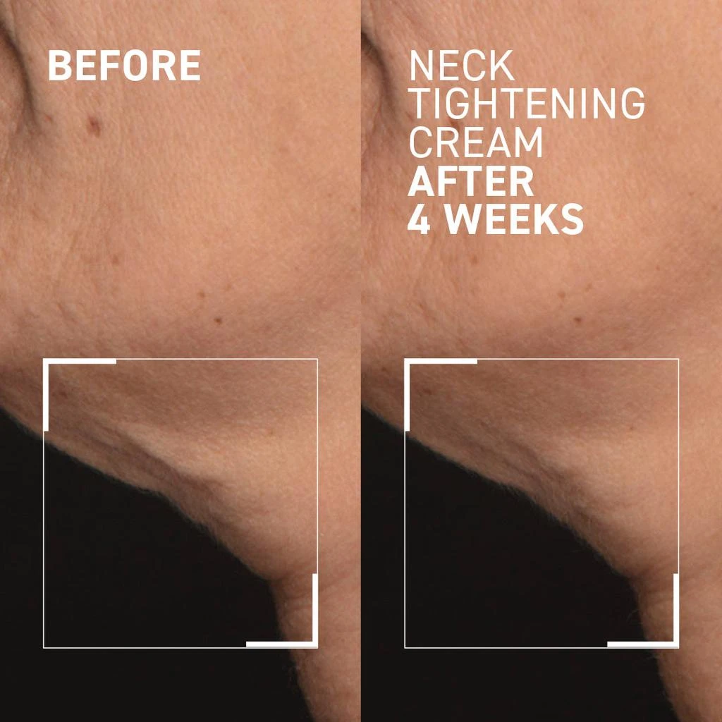 Dr. Brandt NECK TIGHTENING CREAM + GUA SHA 2