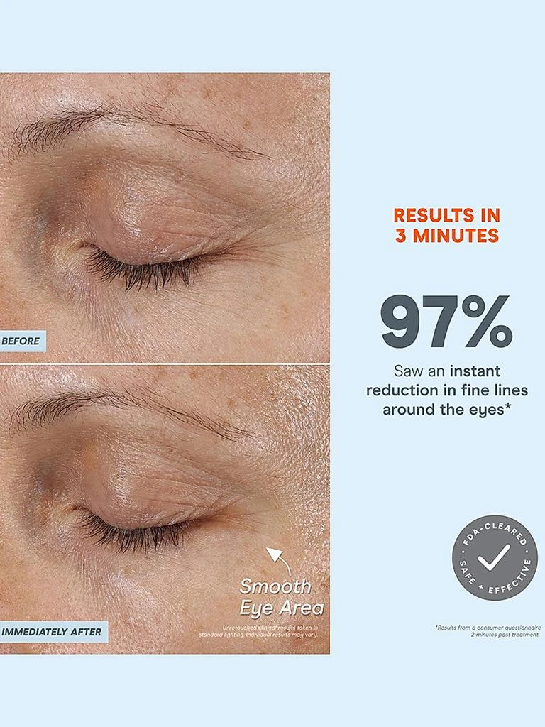 NuFace FIX MicroWand 3