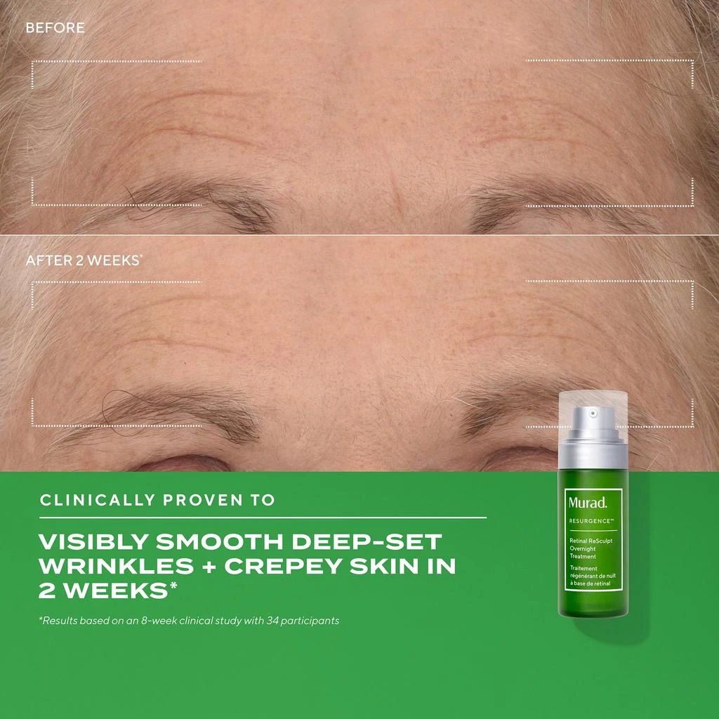 Murad Murad Retinal ReSculpt Overnight Treatment 1 oz 4