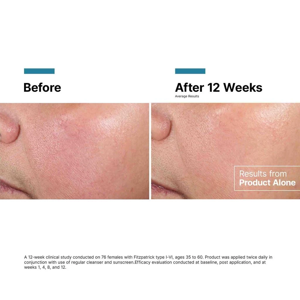 SkinCeuticals SkinCeuticals Advanced RGN-6 Regenerative Cream 6