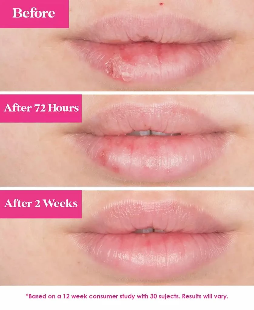 Grande Cosmetics GrandePOUT Plumping Lip Mask - Berry Mojito 6