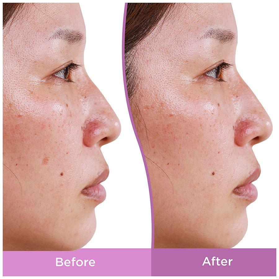 Differin Dark Spot Correcting Serum