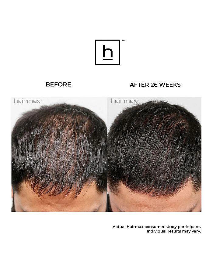 HairMax Ultima 12 Hair Growth LaserComb 9