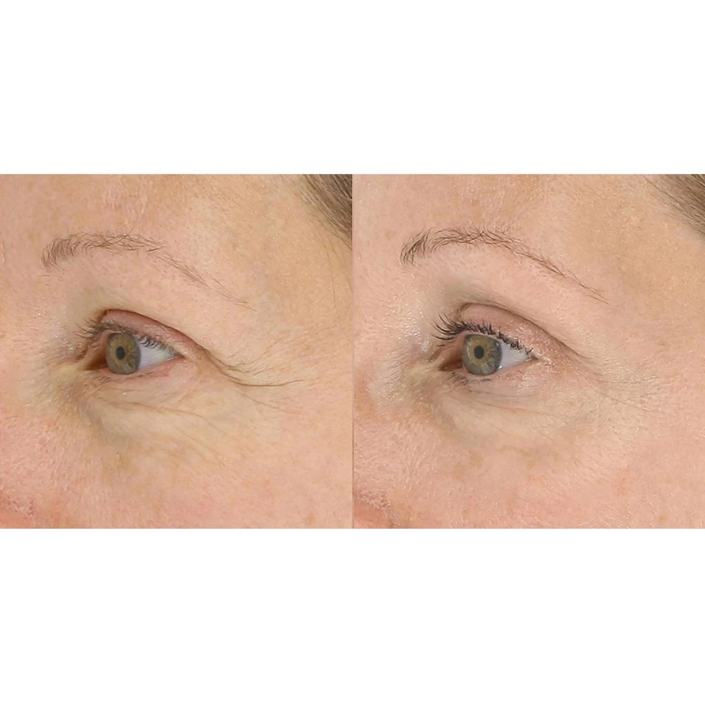 LightStim LightStim for Wrinkles - Peony Pink 6