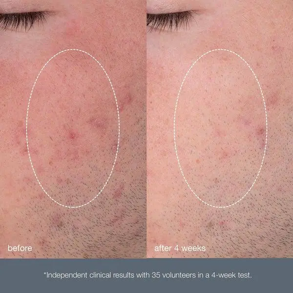 Dermalogica Dermalogica Daily Microfoliant Refill 3