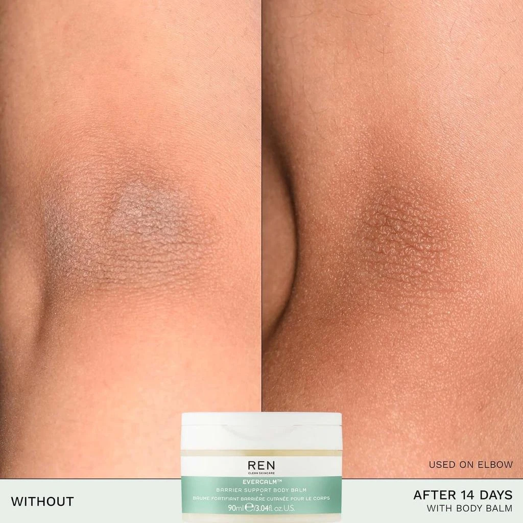 REN Clean Skincare REN Clean Skincare EverCalm Barrier Support Body Balm 100ml 5