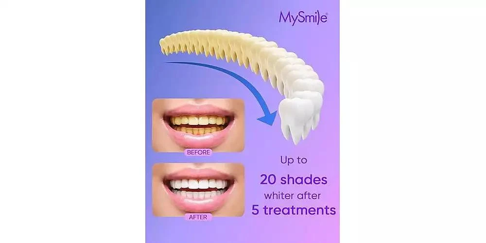 MySmile 4Pcs 35% Non-Sensitive Teeth Whitening Gel Refill Pack Kit for Whitening Teeth, Mint Flavor Teeth Whitener (Not Include LED Mouth Tray) 4