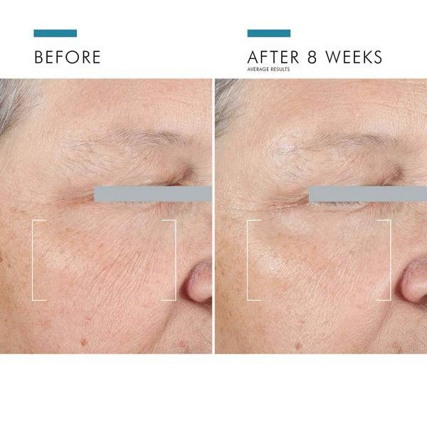 SkinCeuticals SkinCeuticals A.G.E. Advanced Eye (0.5 fl. oz.) 5