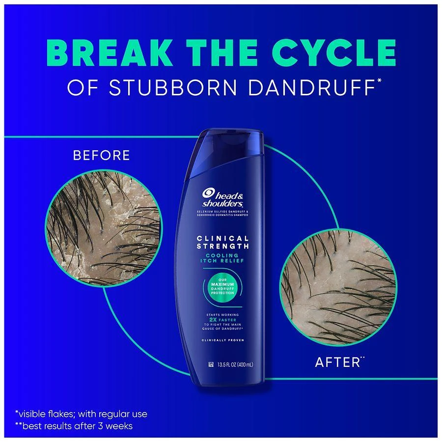 Head & Shoulders Cooling Itch Relief Shampoo, for Stubborn Dandruff 7