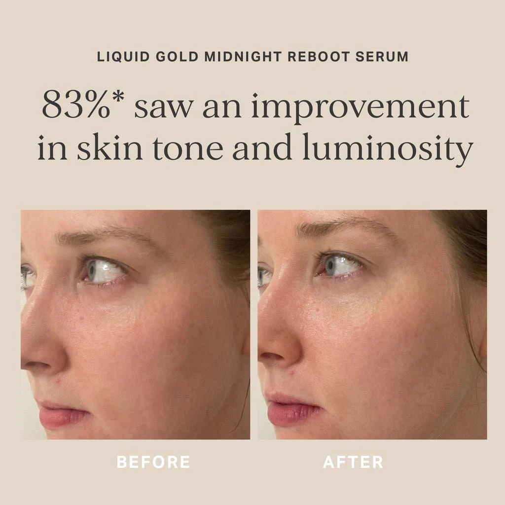 Alpha-H Alpha-H Liquid Gold Midnight Reboot Serum 50ml 11