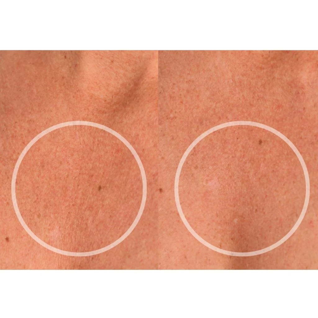 SIO Beauty SiO Beauty Chestlift Patch 3