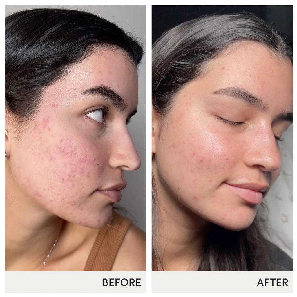 Jane Iredale jane iredale Skin Accumax 14 Week Reset Box 2