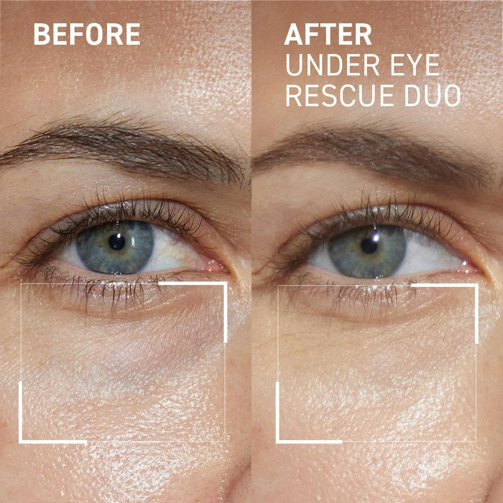 Dr. Brandt Skincare Eye Puffiness 
Fatigue Duo 2