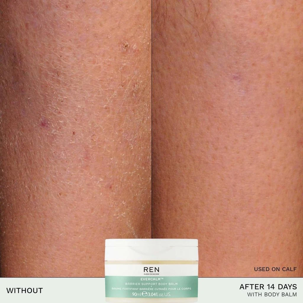 REN Clean Skincare REN Clean Skincare EverCalm Barrier Support Body Balm 100ml 6