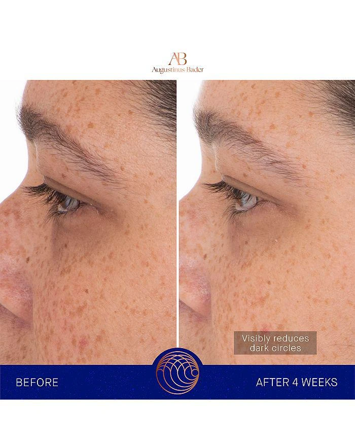 Augustinus Bader The Eye Patches 15