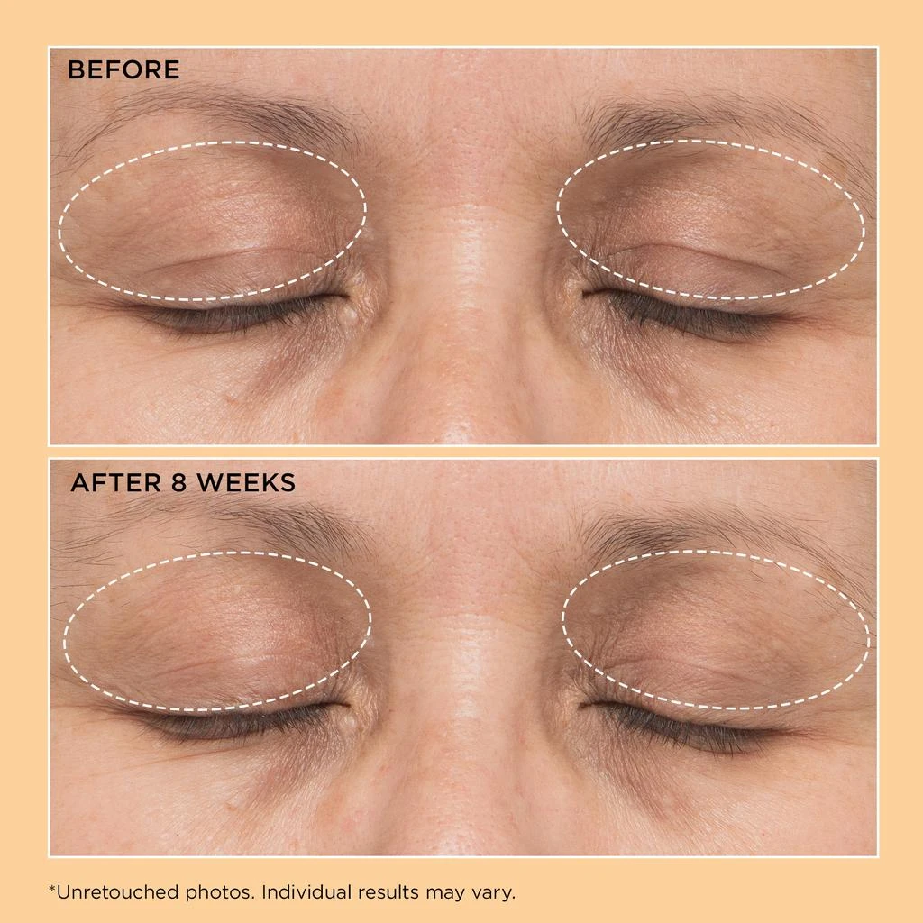 Perricone MD Neuropeptide Lift 
Correct Duo 5