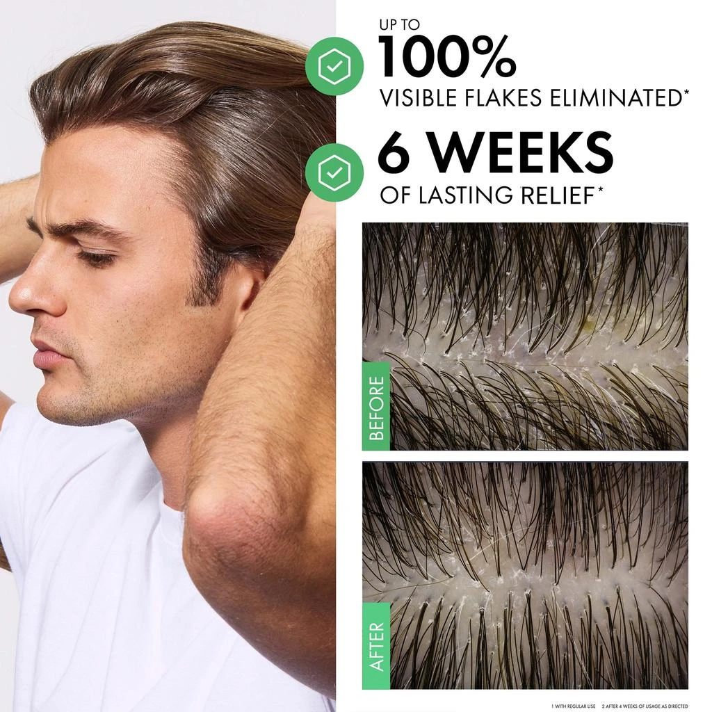 Vichy Vichy Dercos Selenium Sulfide Anti-Dandruff Shampoo 4