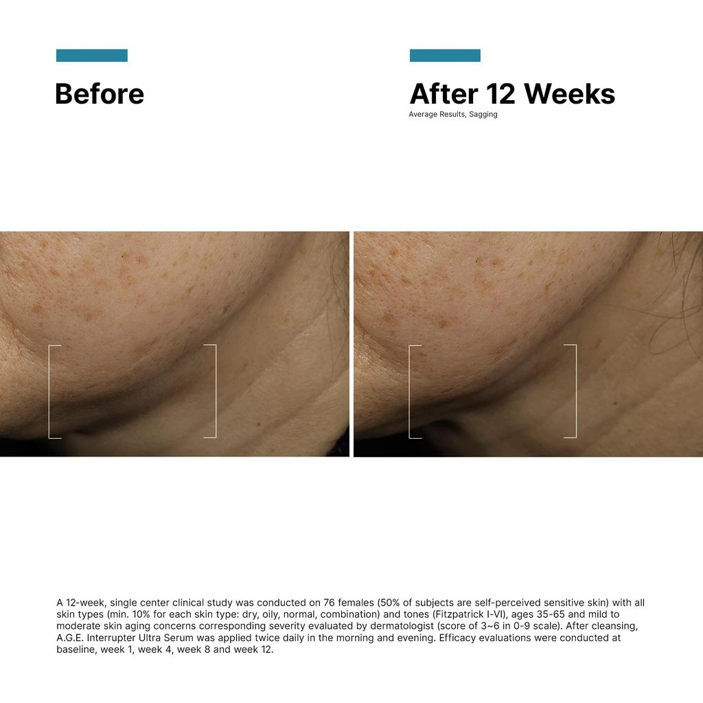 SkinCeuticals SkinCeuticals A.G.E. Interrupter Ultra Serum 11