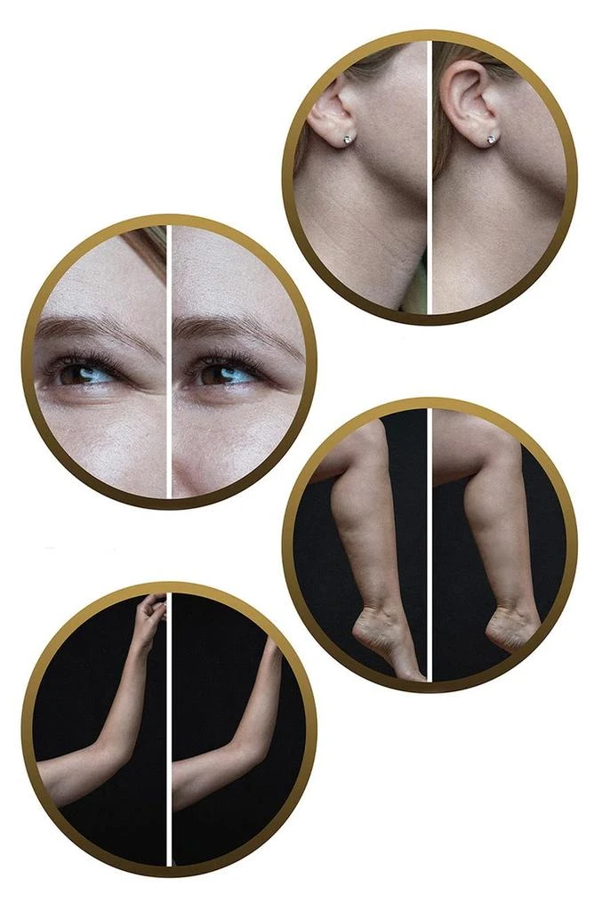 PURE DAILY CARE DermaWave Clinical Radio Frequency Skin Tightening Machine 6