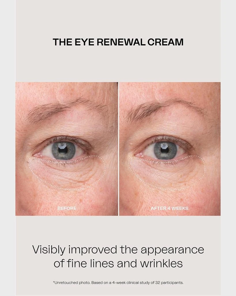 EIGHTH DAY The Eye Renewal Cream, 0.5 oz. 5