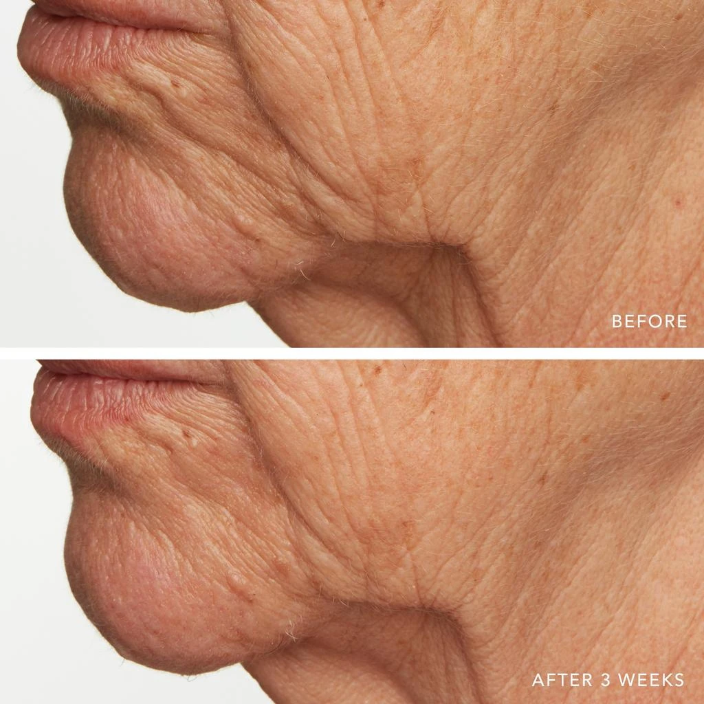 Lancer Skincare Lancer Skincare Intensive Night Treatment with Hylaplex and Marula Oil 7