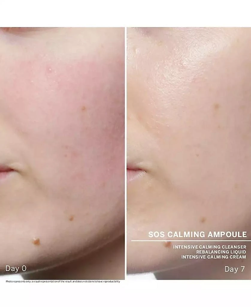 BABOR SOS Calming Ampoule Concentrates 3