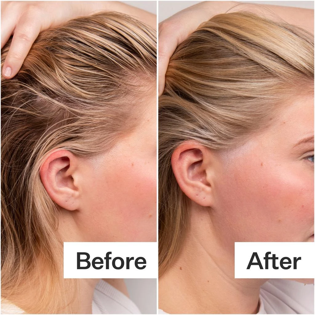 Act+Acre Act+Acre 4% Niacinamide Oily Scalp Serum 2.2 oz 9