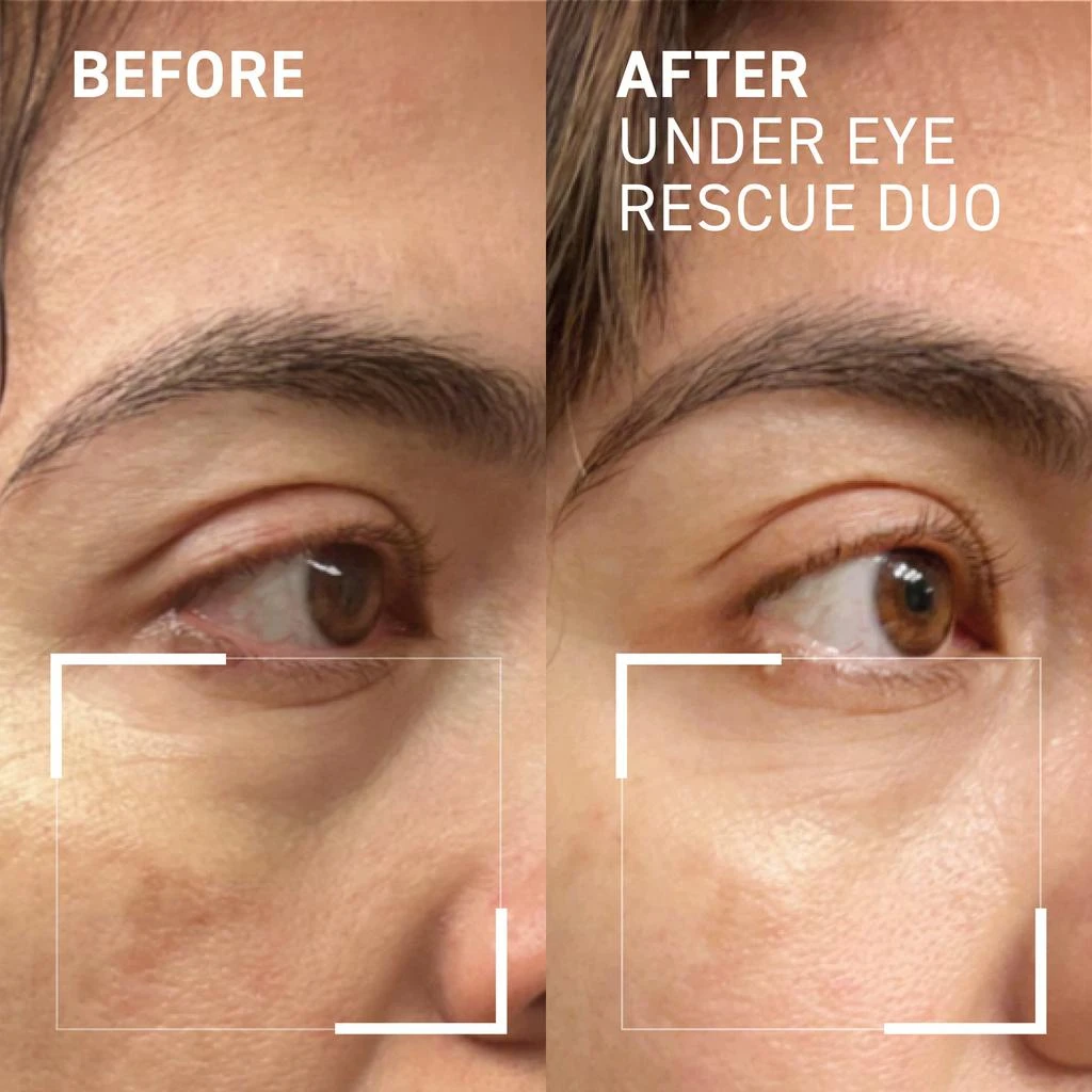 Dr. Brandt UNDER EYE RESCUE DUO 3