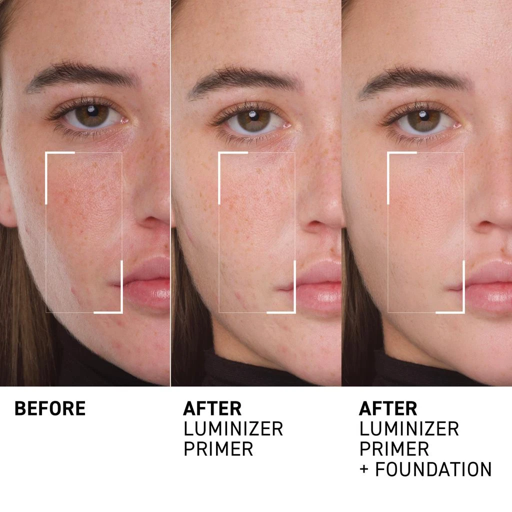 Dr. Brandt Skincare Quick Fix Kit - One Kit - 4 Instant Results - 4 Bestsellers 4
