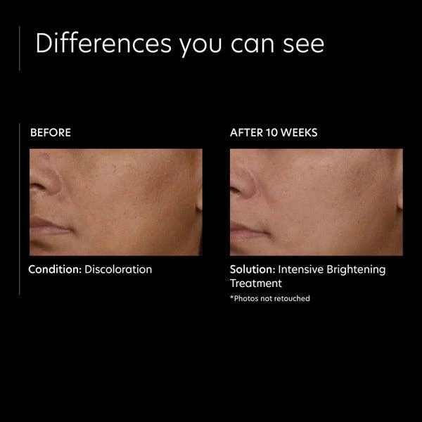 PCA SKIN PCA SKIN Intensive Brightening Treatment 0.5 Percent Pure Retinol Night 4