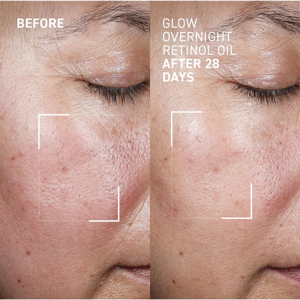 Dr. Brandt Skincare GLOW OVERNIGHT RETINOL OIL™