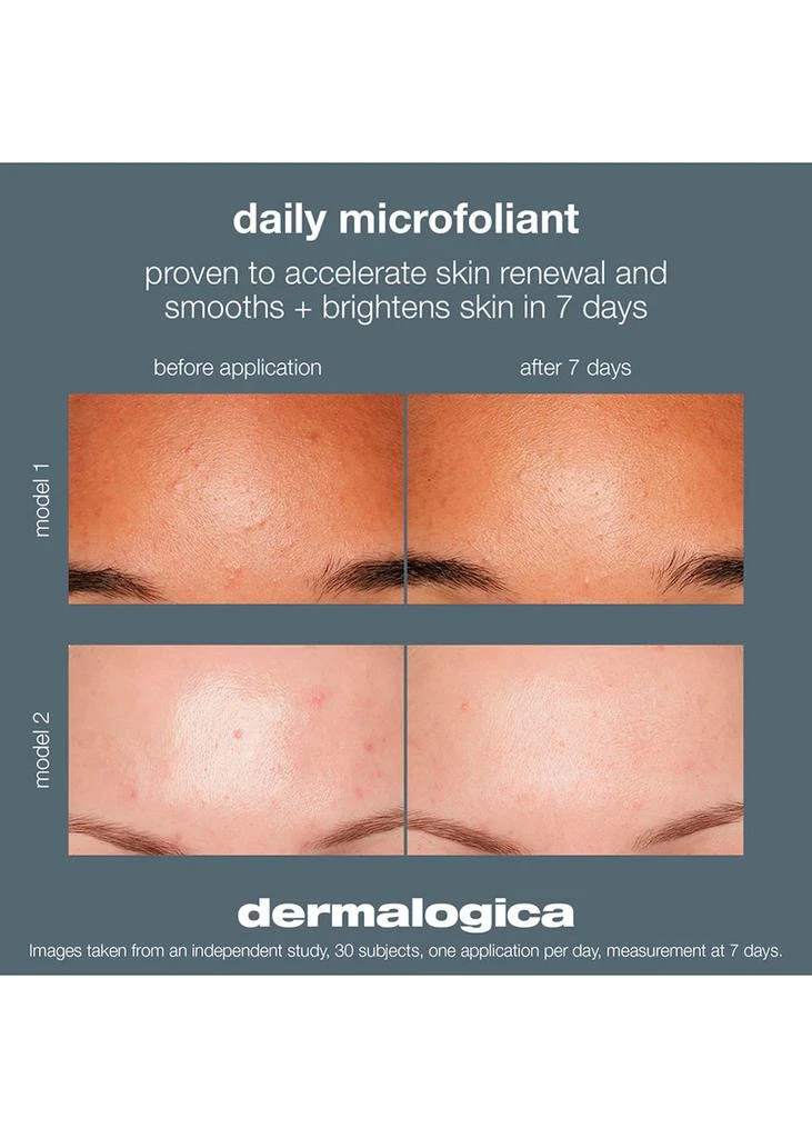 Dermalogica Travel Daily Microfoliant 13g 5