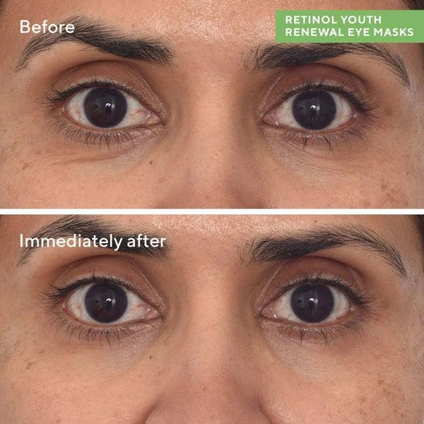 Murad Dr. Zion x Murad Retinol Youth Renewal Eye Masks (5 Pack) 3